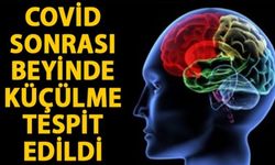 'Covid-19 geçirenlerin beyninde küçülme tespit edildi' (VİDEO)