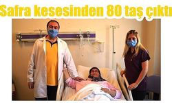 Safra kesesinden 80 taş çıktı