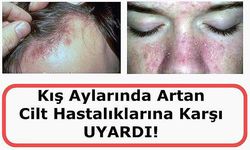 Kış Aylarında Artan Cilt Hastalıklarına Karşı Uyardı