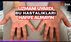 Salgına Dönüşen El, Ayak, Ağız Hastalığı Hafife Alınmamalı (VİDEO)