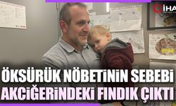 1,5 aydır öksürük nöbeti geçiriyordu sebebi akciğerindeki fındık çıktı (VİDEO)