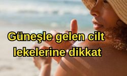 Güneşle gelen cilt lekelerine dikkat