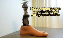 Bu yöntem amputasyon hastalarına umut oldu