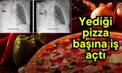 Yediği pizza başına iş açtı