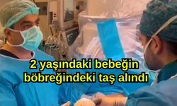 2 yaşındaki bebeğin böbreğindeki taş alındı