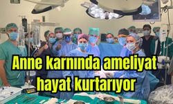 Anne karnında ameliyat hayat kurtarıyor (Video)