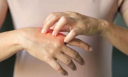 "Kış aylarında görülen deri hastalıklarına dikkat"