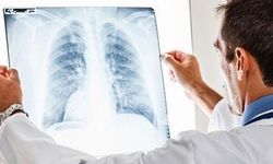 "Havaların soğumasıyla zatürre vakaları artıyor"