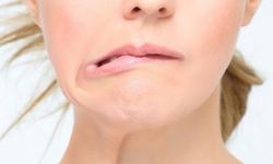 Geçici felç hafife alınmamalı