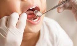 Çocuklarda ağız ve diş sağlığında erken tanı büyük öneme sahip