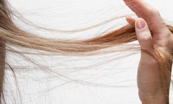 "Kadınlarda saç dökülmesinin gizli nedenleri"