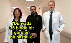 "Dünyada 35 binde bir görülen bir hastalık" (Video)