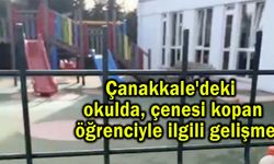 Çanakkale'deki okulda çenesi kopan öğrenciyle ilgili gelişme