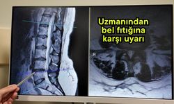 Uzmanından bel fıtığına karşı uyarı (Video)