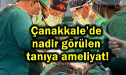 Çanakkale’de nadir görülen tanıya ameliyat!
