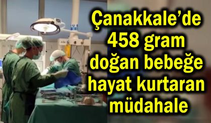 Çanakkale’de 458 gram doğan bebeğe hayati müdahale