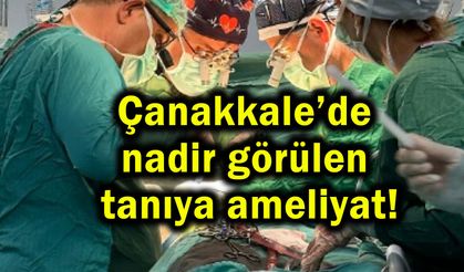 Çanakkale’de nadir görülen tanıya ameliyat!