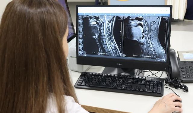 MS hastalığında erken teşhis hayat kalitesini arttırıyor
