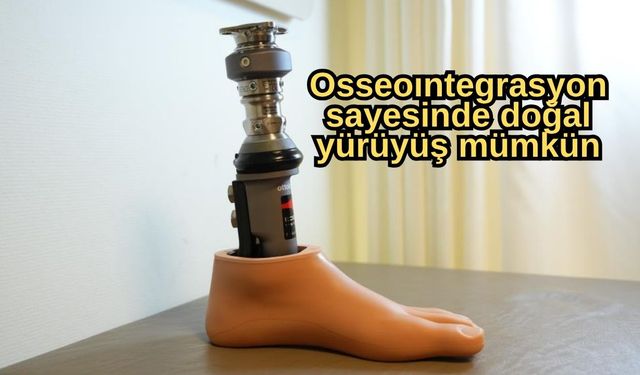 Bu yöntem amputasyon hastalarına umut oldu