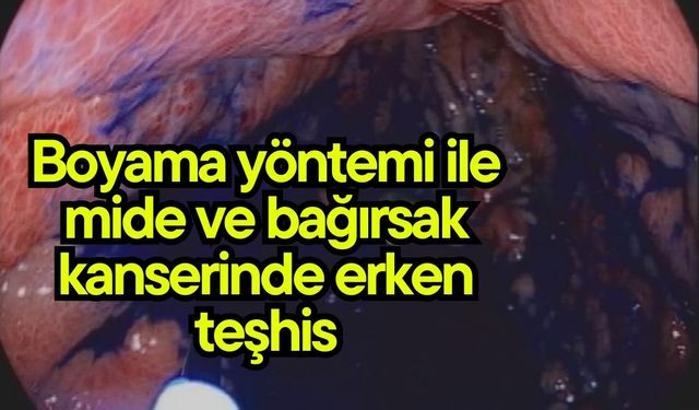 Boyama yöntemi ile mide ve bağırsak kanserinde erken teşhis (Video)