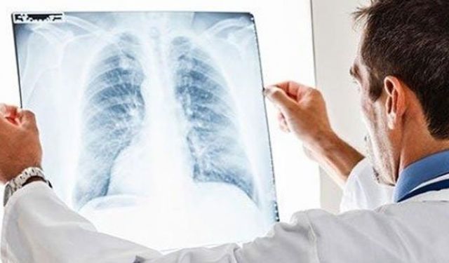 "Havaların soğumasıyla zatürre vakaları artıyor"