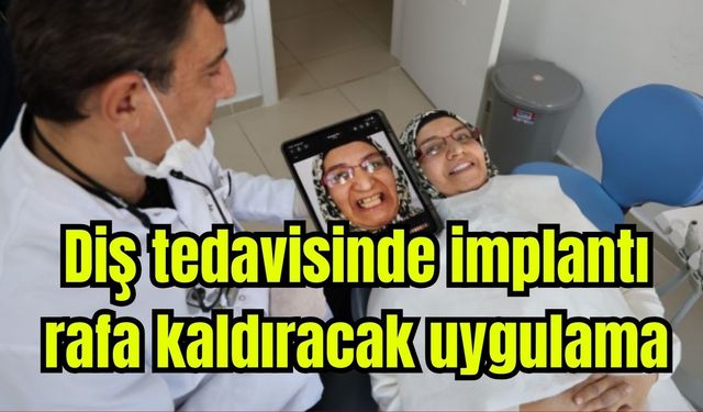 Diş tedavisinde implantı rafa kaldıracak uygulama (Video)