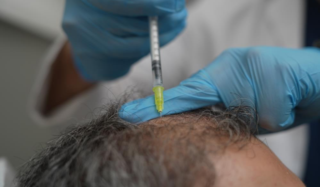 Dökülen saçlar vücudun bir alarmı olabilir