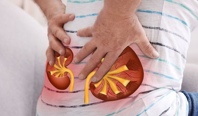 Böbrek taşı vakalarında kişiye özel tedavi