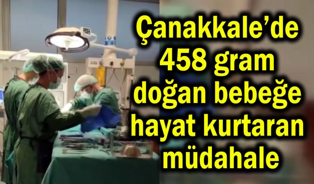 Çanakkale’de 458 gram doğan bebeğe hayati müdahale