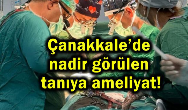 Çanakkale’de nadir görülen tanıya ameliyat!