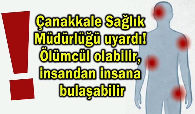 Çanakkale Sağlık Müdürlüğü uyardı!