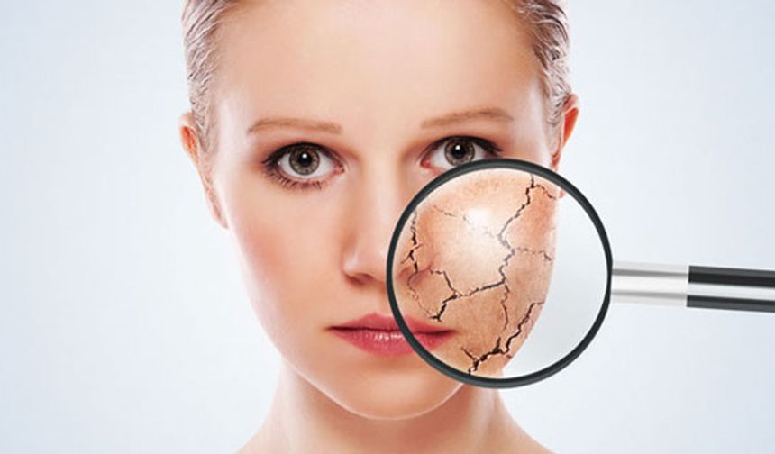 Dermatoloji uzmanından kış cilt bakımının püf noktaları