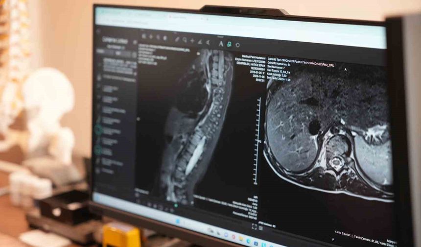 Sinsi ilerleyen bu rahatsızlığı ilk fark eden anneler oluyor