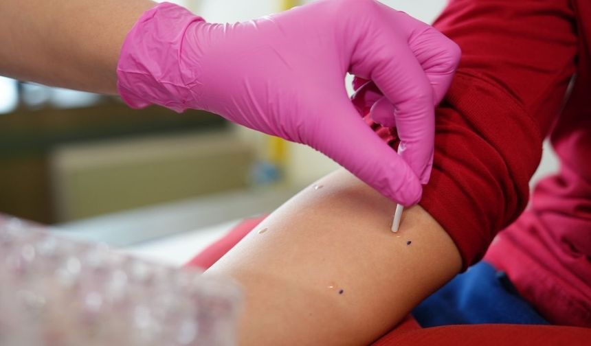 Sabah Hapşırıklarına Dikkat! Alerjiyle Savaşmanın Yolları