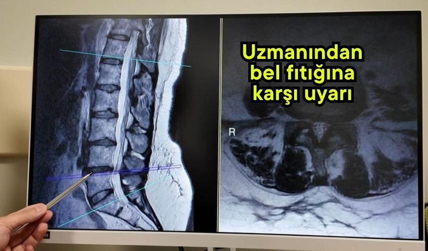 Uzmanından bel fıtığına karşı uyarı (Video)