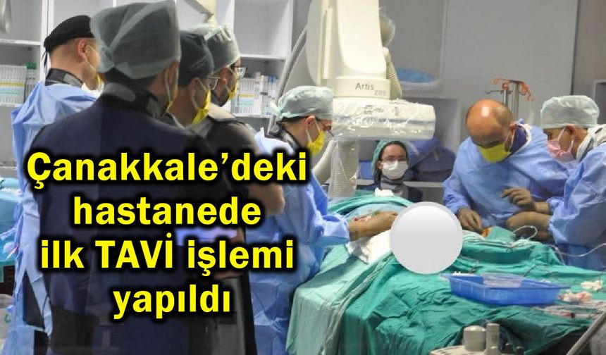 Çanakkale’deki hastanede ilk TAVİ işlemi yapıldı