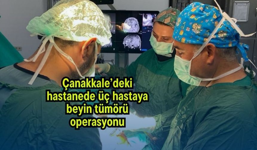 Çanakkale’deki hastanede üç hastaya beyin tümörü operasyonu